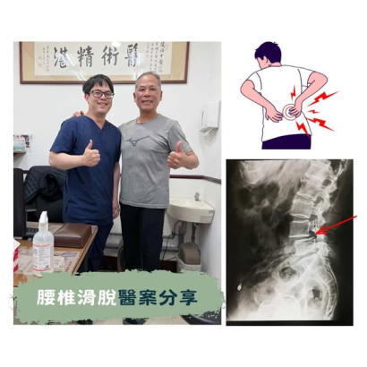 腰椎椎間盤突出 - 醫案一